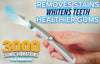 Dental Scaler Polishing Vibrating Dental Instrument